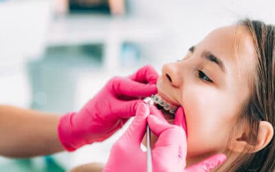The Secret Behind Finding the Best Dentist for Kids