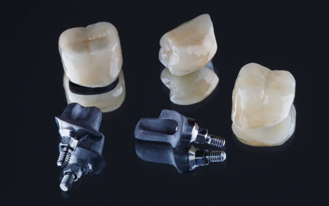 choosing dental crowns
