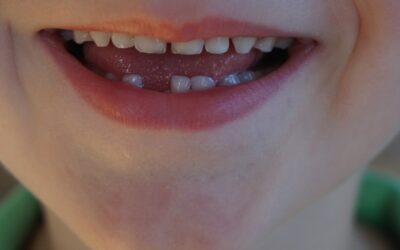 7 Fun Ways to Pull Out a Tooth for Children