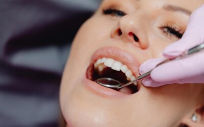 What Color Are Cavities? A Guide for Concerned Parents
